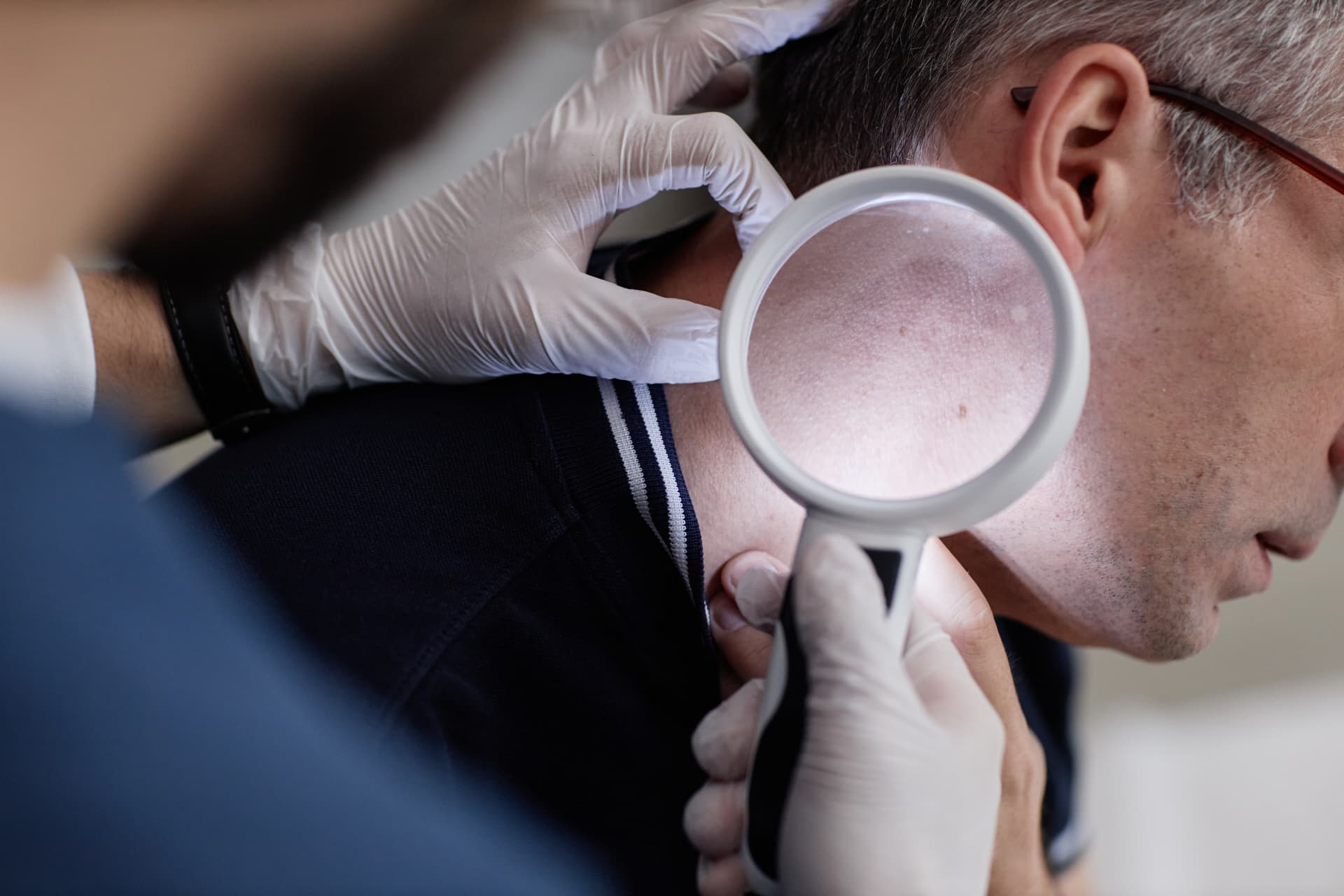 Q-Switch Laser for Pigmentation in Riyadh City: Questions to Ask